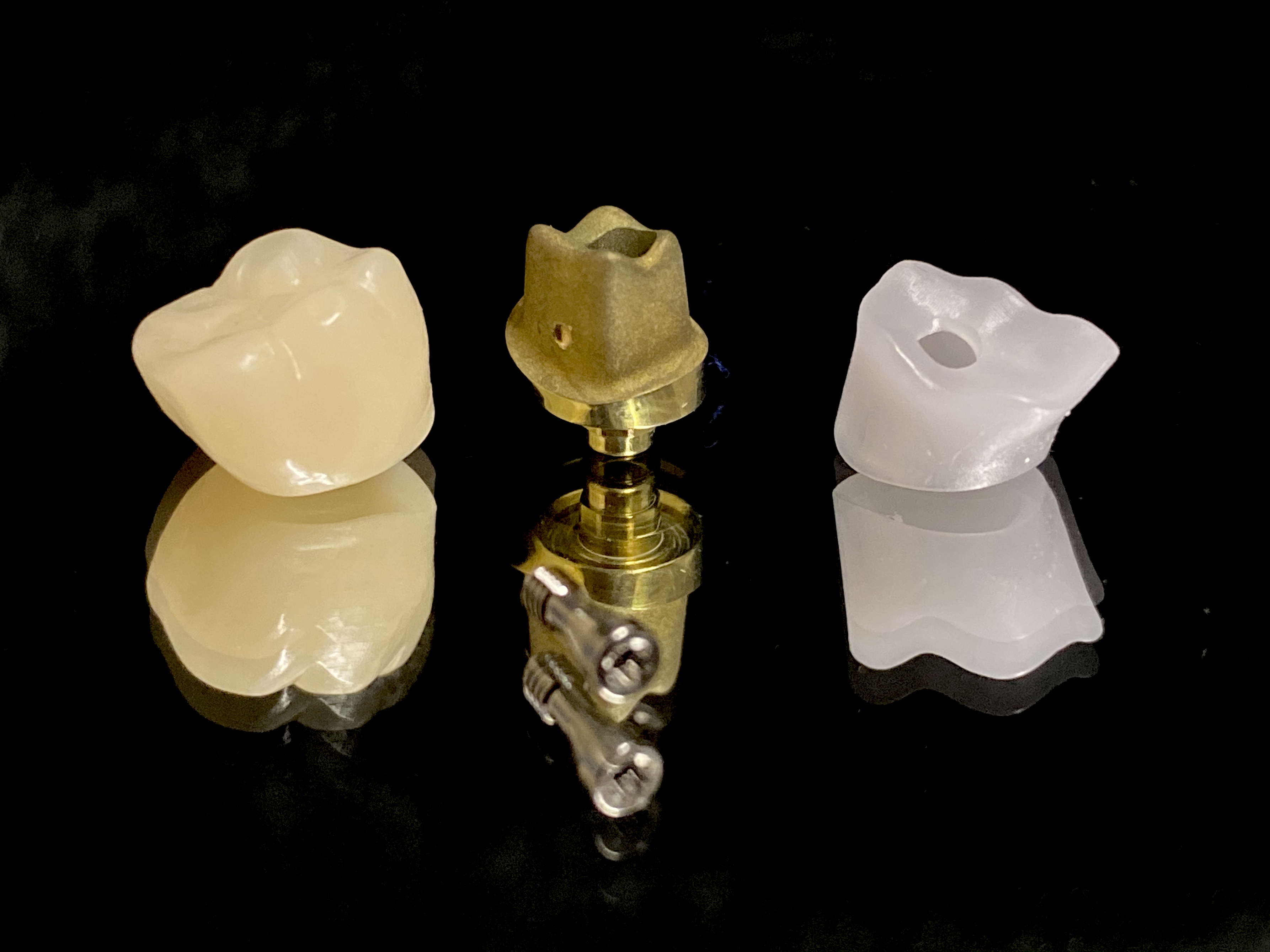 with PMMA temp and wax coping