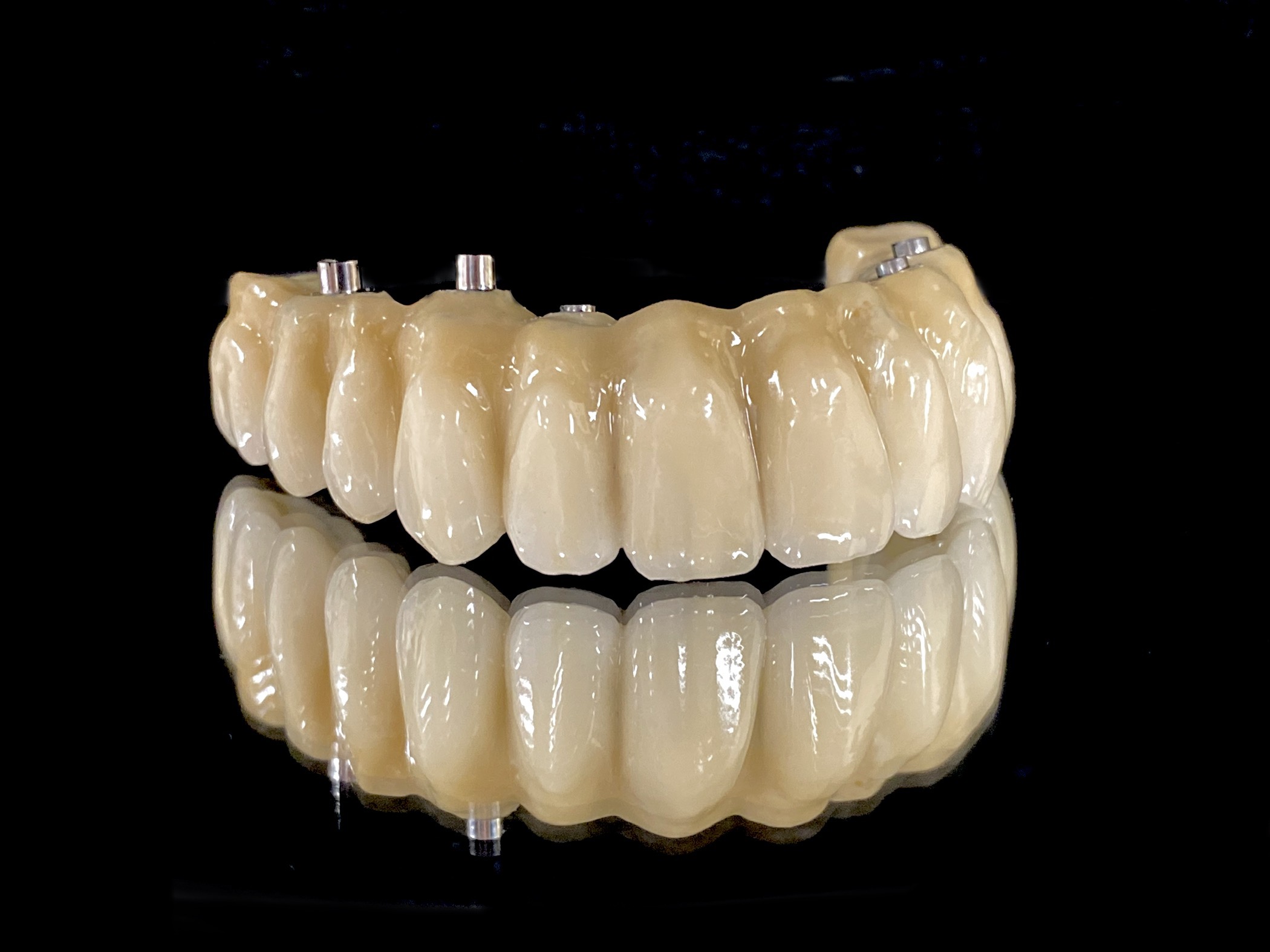Direct to Fixture restoration