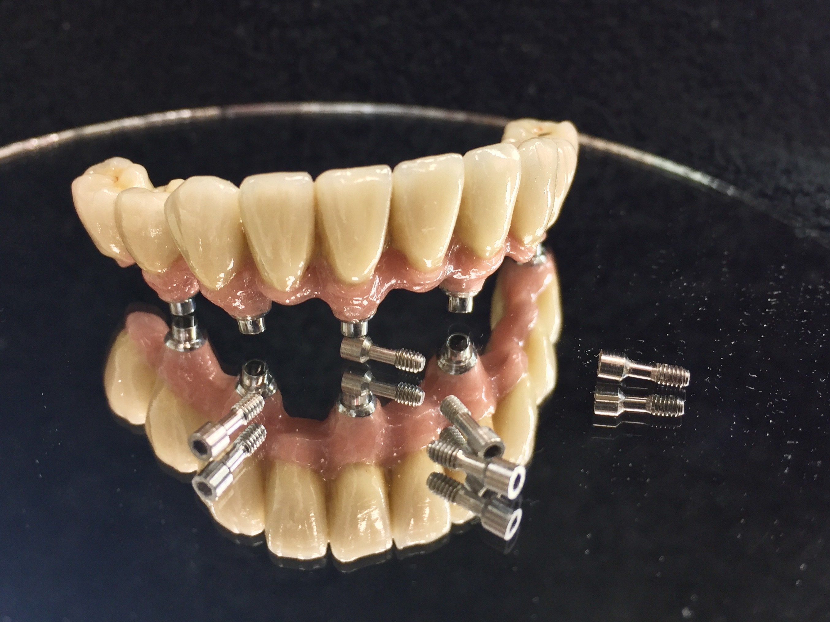 5 Axis Dental gallery