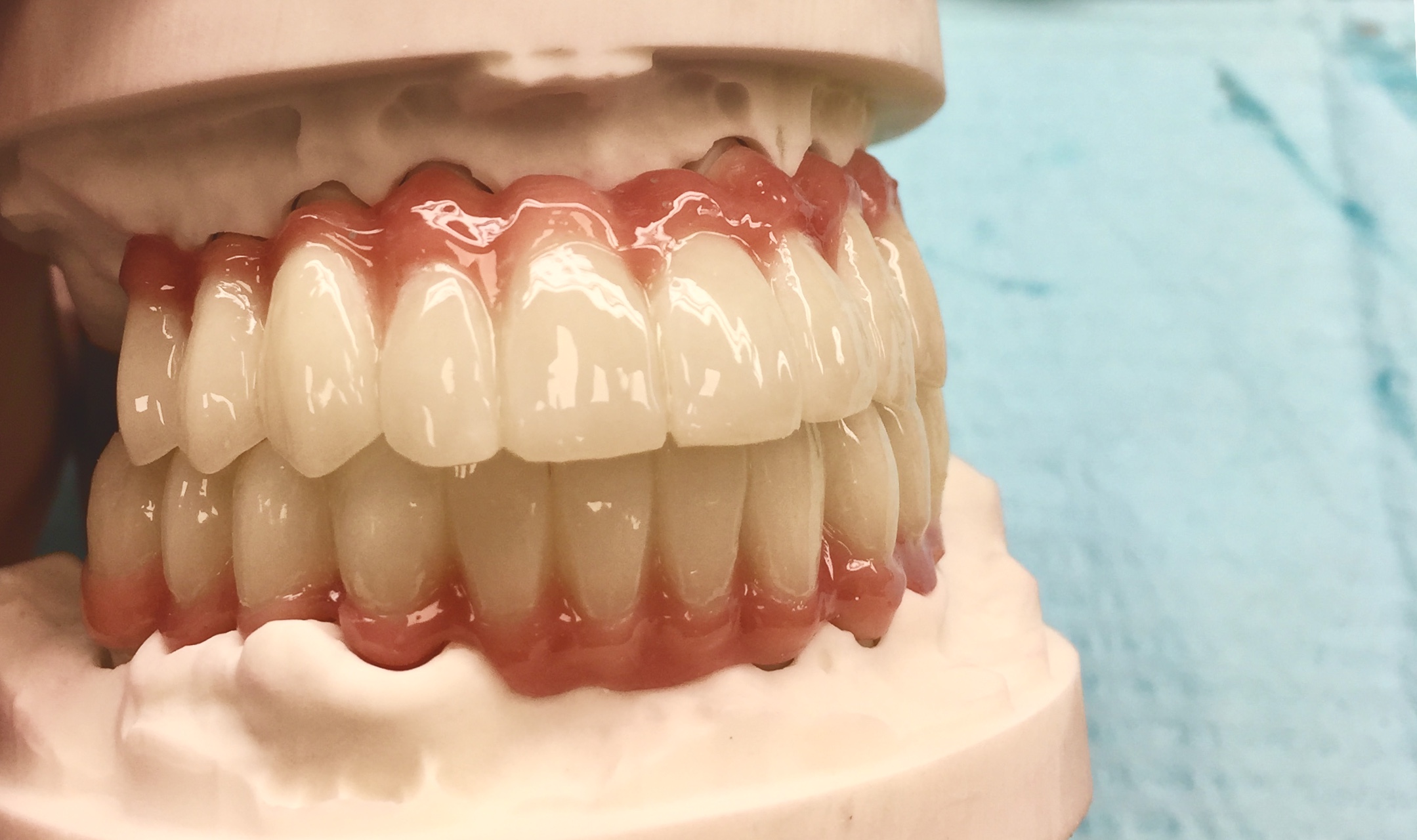 5 Axis Dental gallery