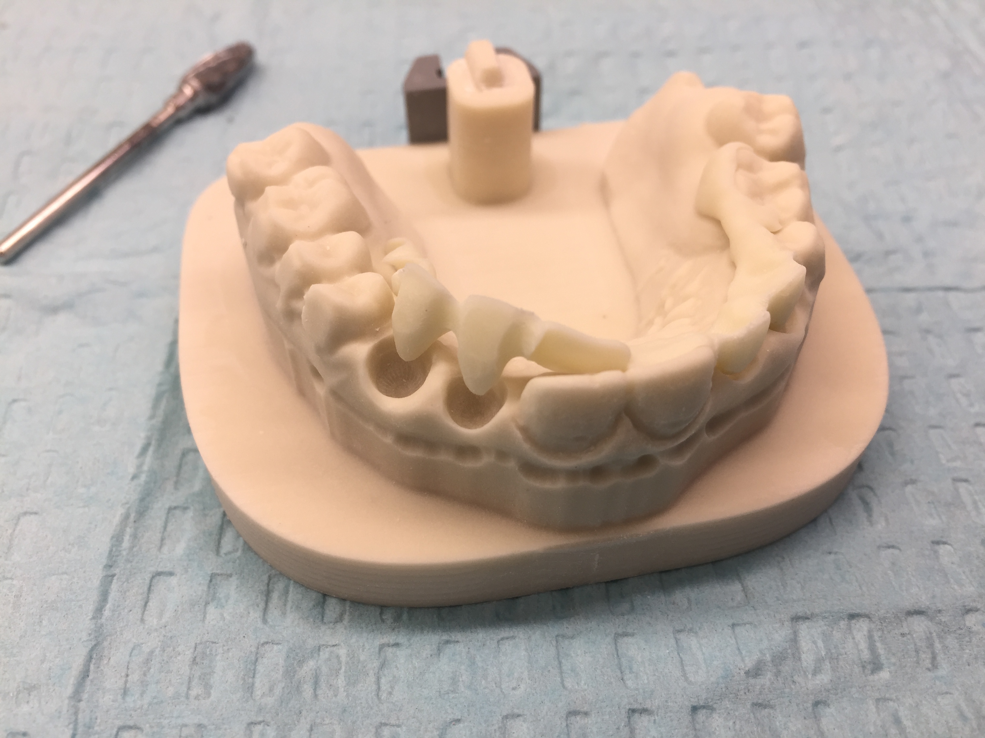 5 Axis Dental gallery
