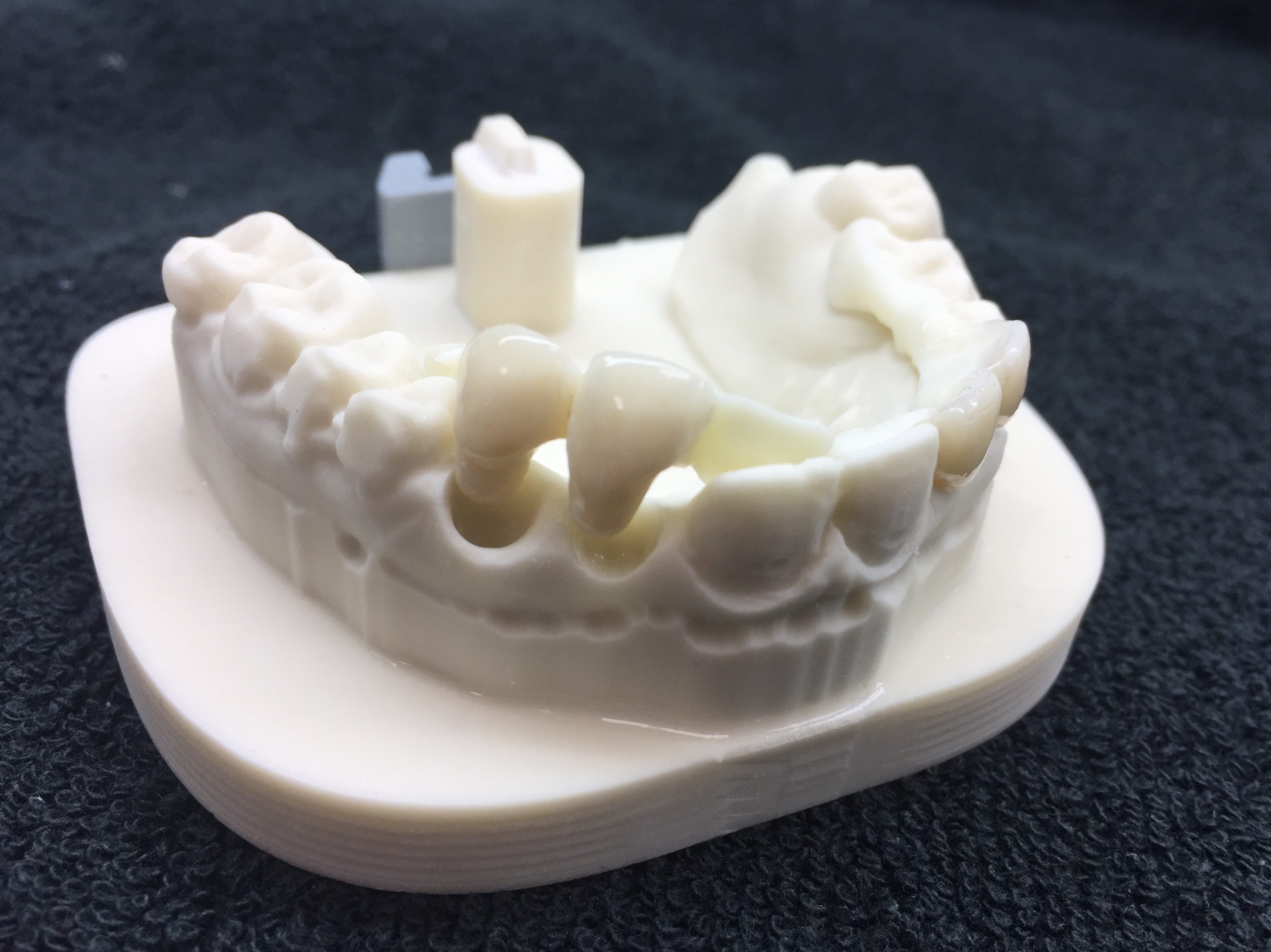 5 Axis Dental gallery