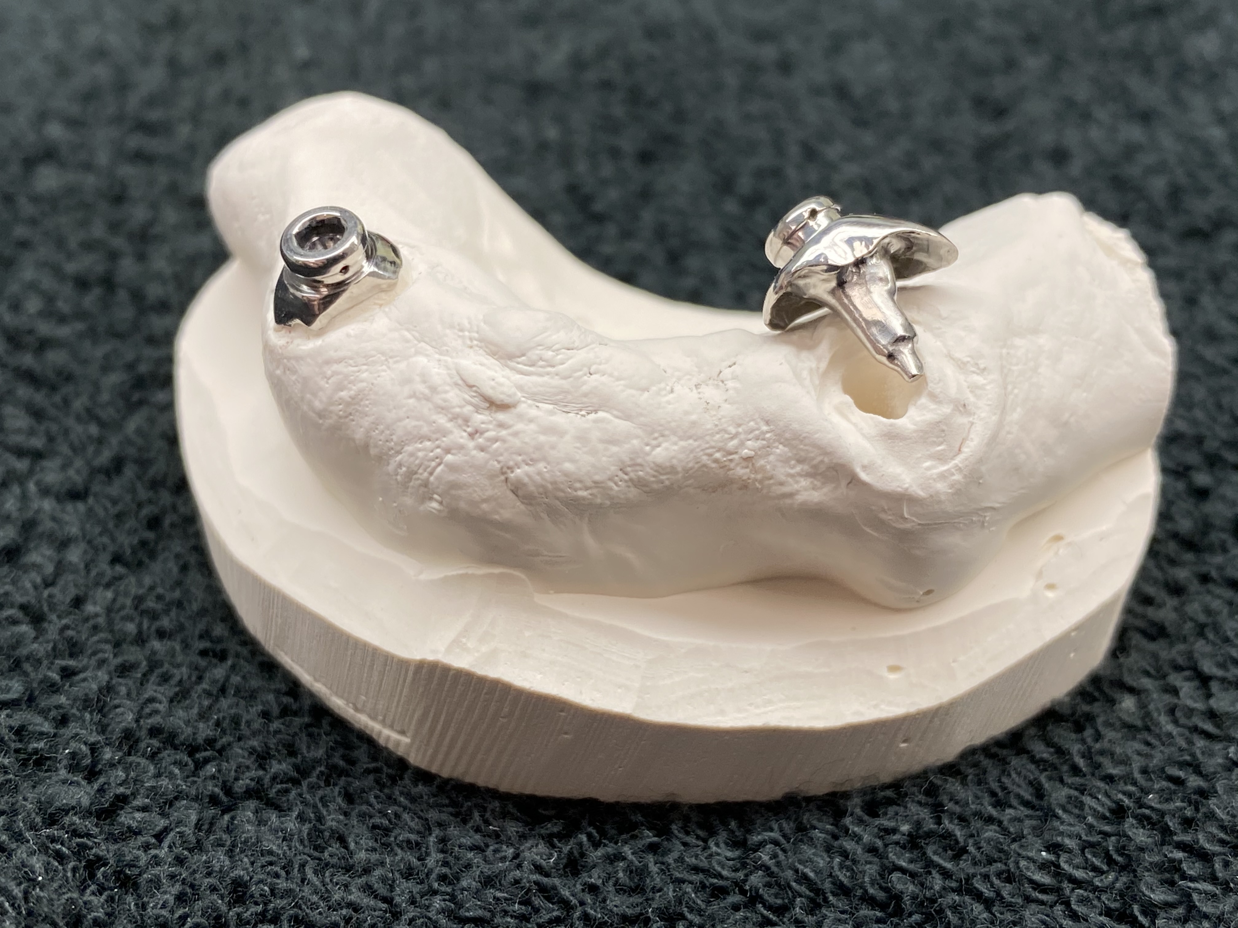 5 Axis Dental gallery