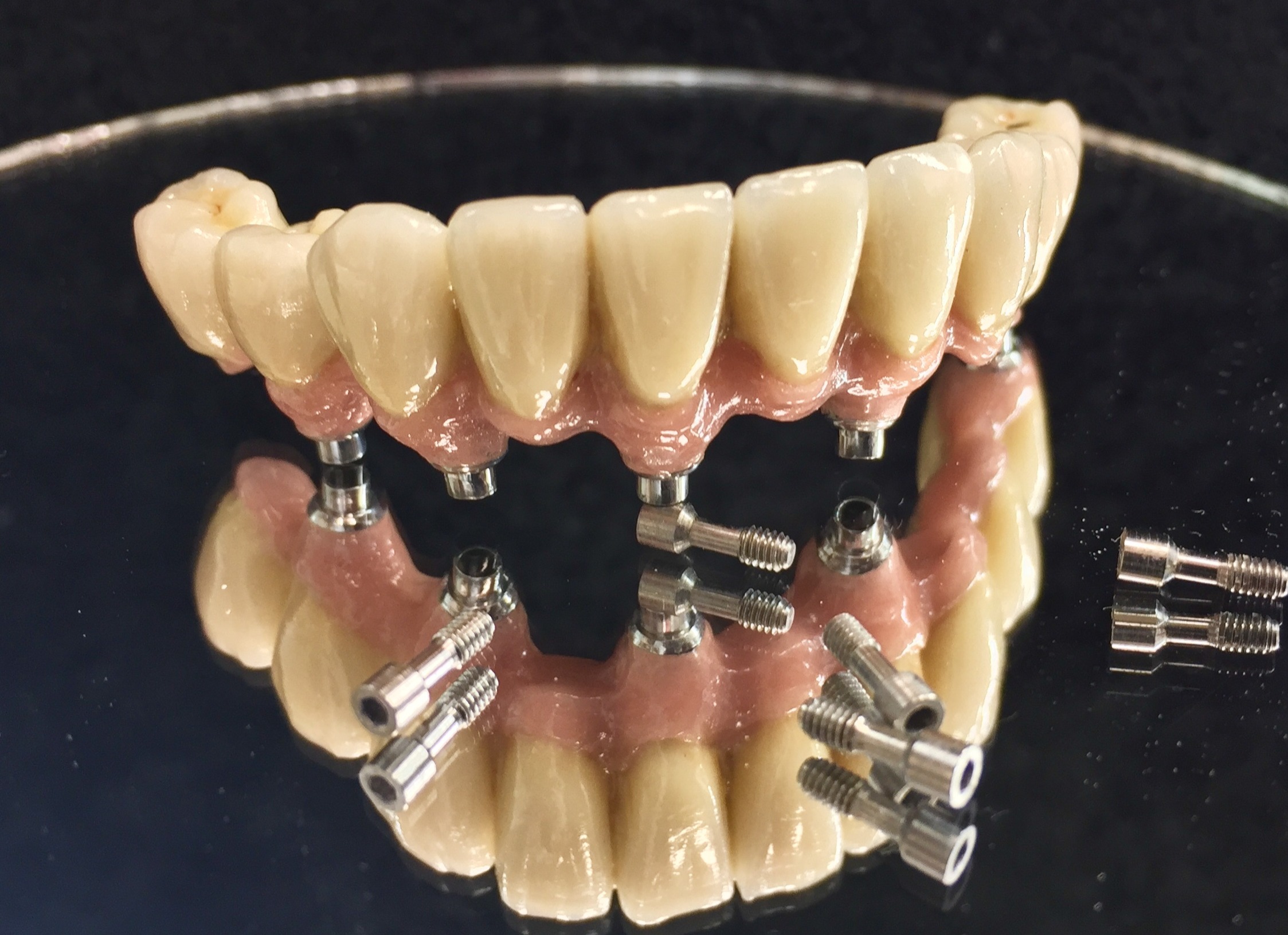 Implant Solutions